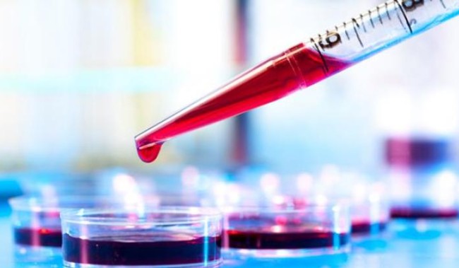 adidrastiria aimatologikes exetaseis F 1089844981